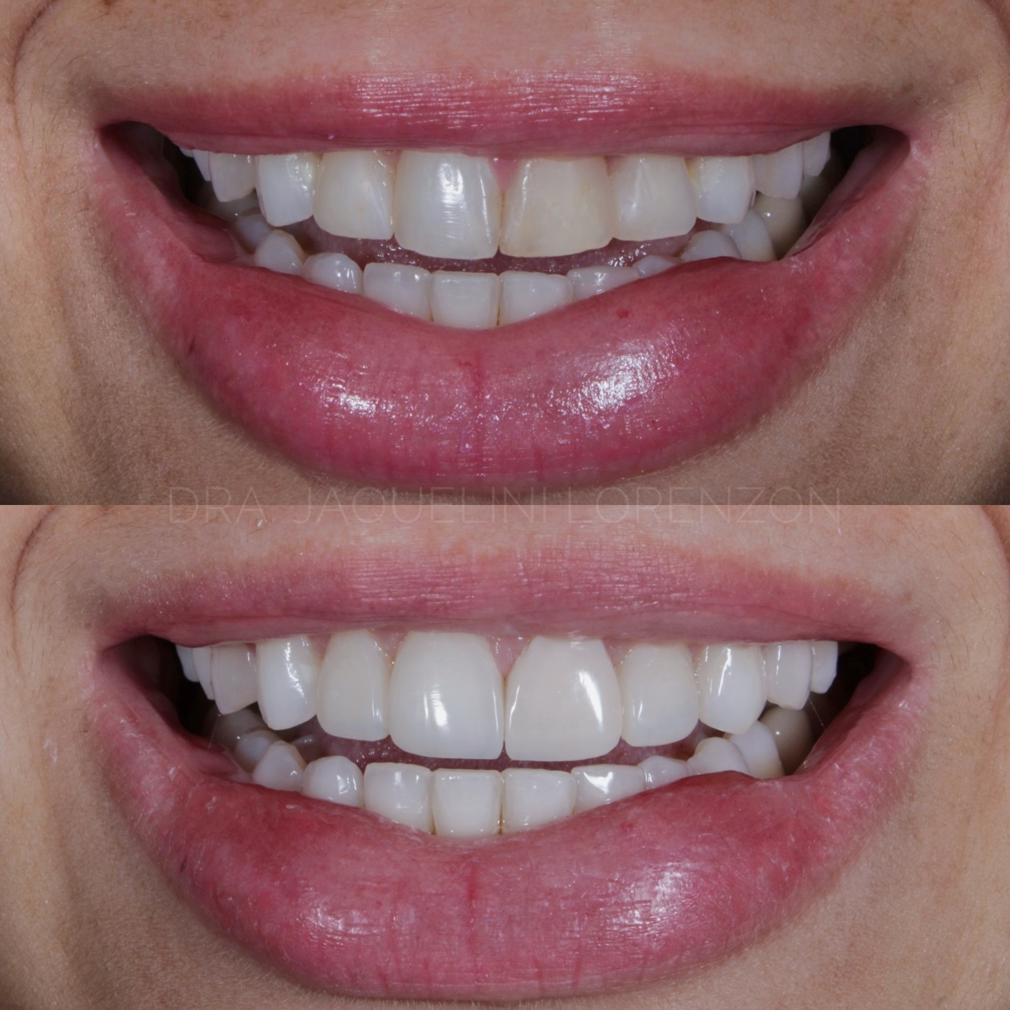 Antes e depois 1