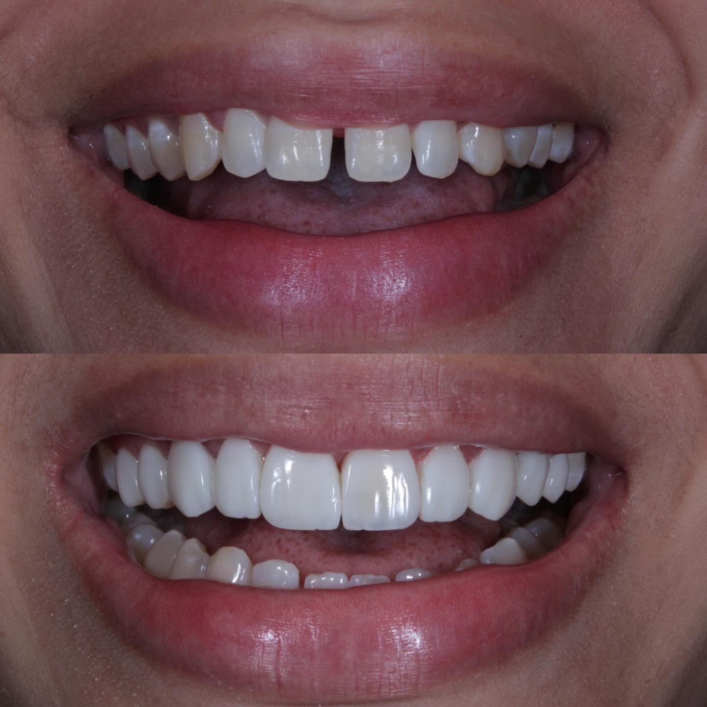 Antes e depois 5